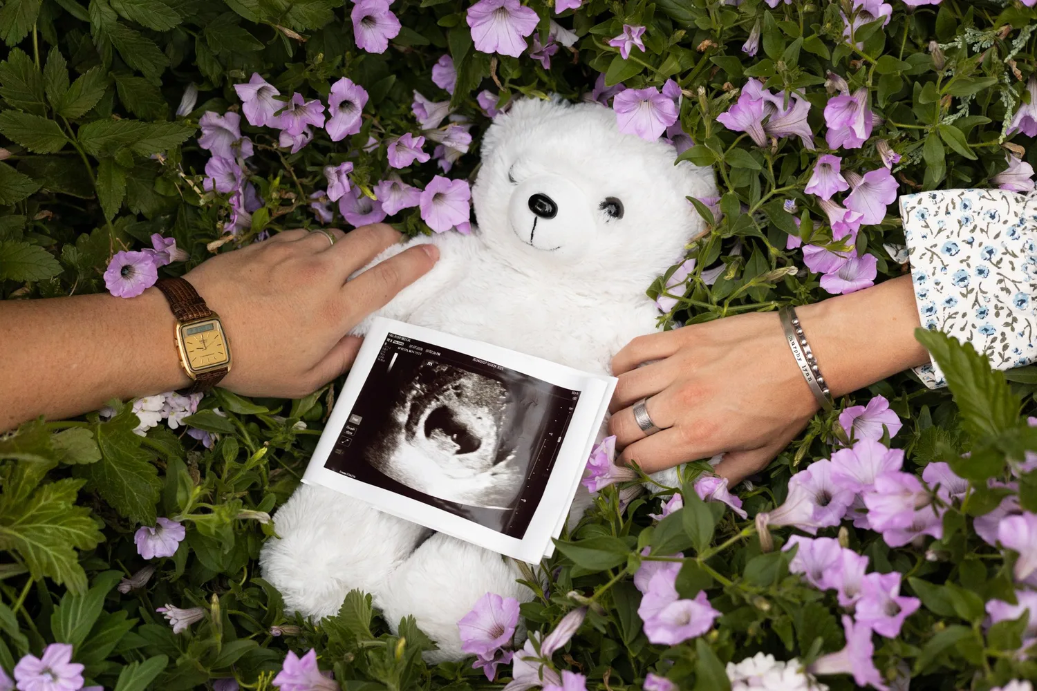 Couple's hands holding a white teddy bear and an ultrasound photo on purple flowers